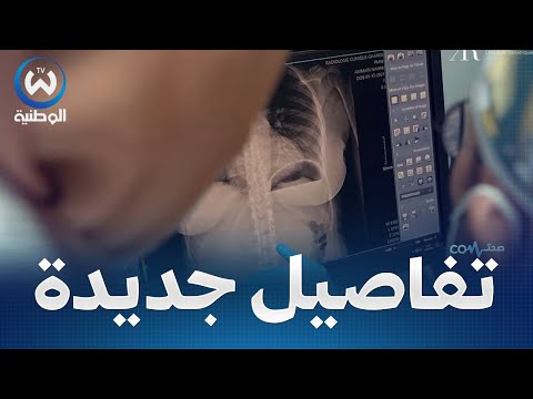 مختصة في الطب التجميلي تكشف عن أحدث تقنيات و طرق عملية شفط الدهون