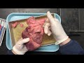 Heart Anatomy and Function Assessment