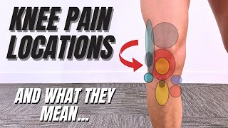 Knee Pain While Running? Identify It by Location!