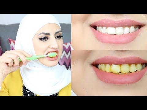 خلطة لتبييض الاسنان من أول استخدام-لازم الكل يجربها