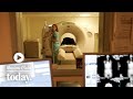 Cancer Risk Factors and Prevention Strategies