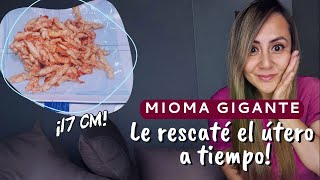 Mioma gigante de 17 cm:  ¡El útero fue rescatado a tiempo!