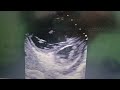 Video Engagement and Viewer Interaction
