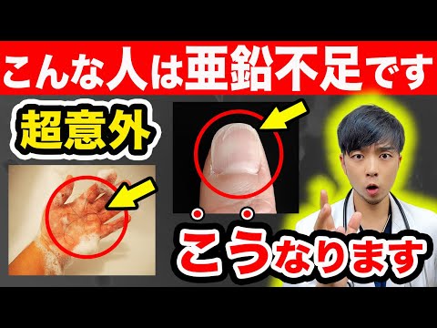 【危険】知らないと後悔する『亜鉛不足』の意外なサイン６選【簡単に補えます】医師解説の亜鉛を効果的に吸収する方法