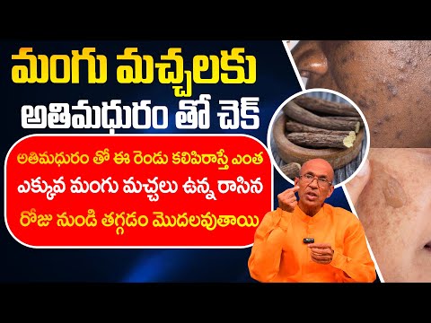 మంగు మచ్చలకు అతిమధురం తో చెక్ | Natural Home Remedies for Pigmentation | Remove Dark Spots Naturally