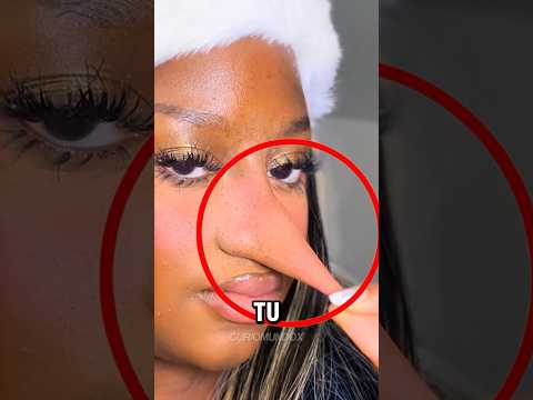 ¡Su Nariz No Deja De Crecer! 👃😱 #shorts #nariz #perro