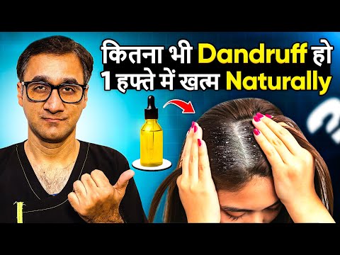 Dandruff का Permanent Solution at Home (For Men & Women) | Healthy India