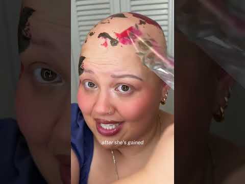 my advice on dating as someone who isn’t the beauty standard #baldiechi #alopeciaawareness