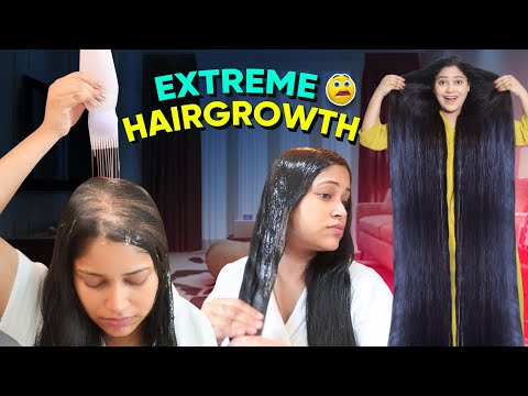 😱I Applied only Few Drops of this Diy & Got Triple Hairgrowth गंजेपन से तुरंत बचना है तो ये लगा लो👌