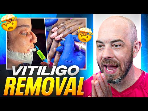 Dermatologist Reacts to TikTok Skin Procedures: What’s Safe vs. Sketchy?