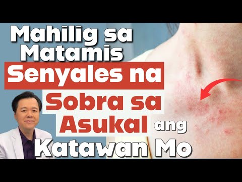 Mahilig sa Matamis: Senyales Na Sobra Na Sa Asukal ang Katawan.