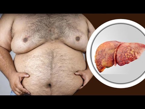 আপনার লিভার কি ধ্বংসের পথে? একটি শাক বদলে দিতে পারে সবকিছু! (কলমি শাকের জাদু)