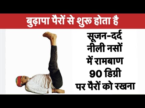 पैरों में सूजन-नीली नसों में रामबाण है 90 डिग्री पर पैरों को रखना॥वेरिकोज़ वेंस॥पैरो में सूजन