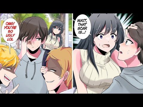 Classmates Laugh About My Scars, But Cute Girl In Class Realizes It's Actually.. (RomCom Manga Dub)