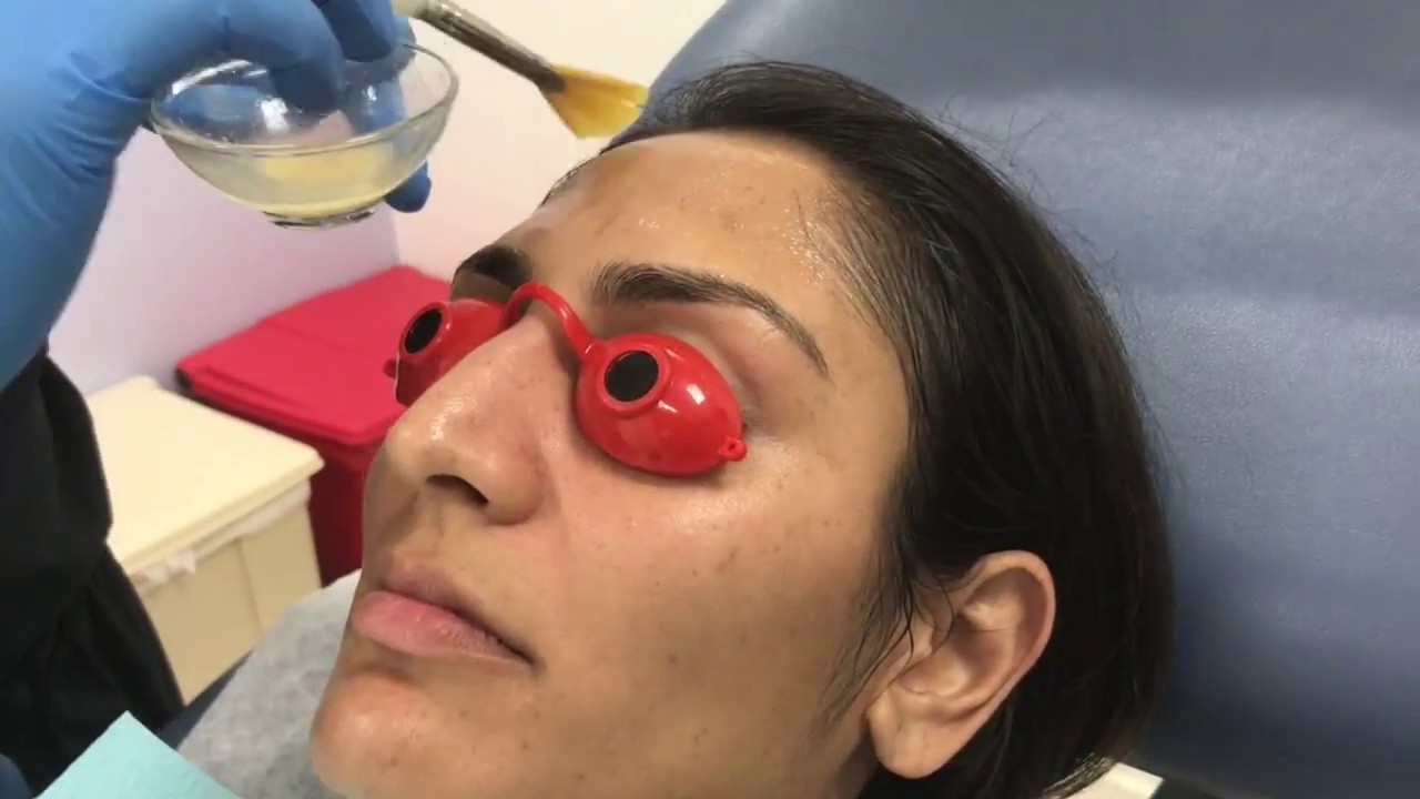 Patient receiving facial treatment in clinic setting.