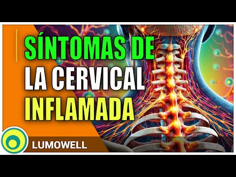 Sintomas de la cervical inflamada