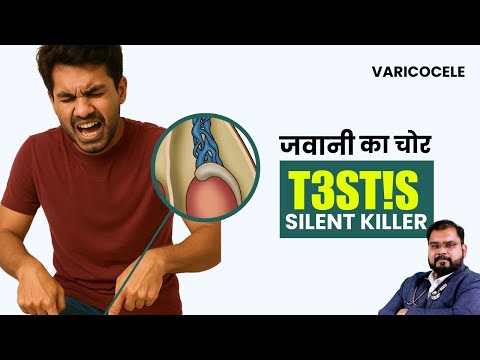 Varicocele : Low Testosterone aur Testicular Pain ka Hidden Cause | 5 Symptoms of Varicocele