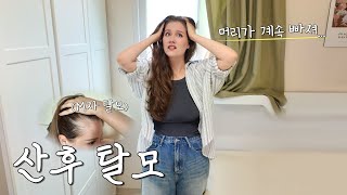 출산 후 M자 탈모로 우울해하는 미국인 아내를 위해 비상금을 쓰면 생기는 일