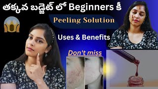 Affordable Peeling Solution 🤗| How to Exfoliate skin| Best Peeling solution review in telugu | 100%