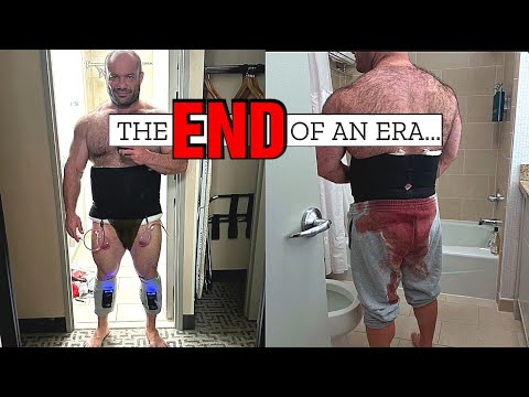 Fart Sound Lat Spread Is Over || Mike Israetel Surgery