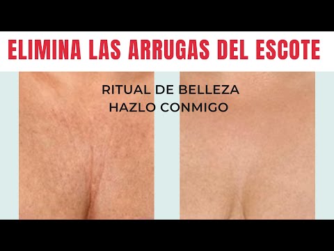 MASAJE PARA EL ESCOTE - ELIMINA ARRUGAS Y TONIFICA LA PIEL / Ritual de belleza hazlo conmigo