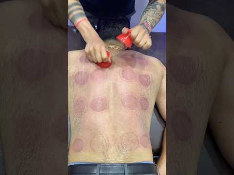 pizza peperoni & Cupping Alinezhad😍#shorts #explore #cuppingtherapy #pizza