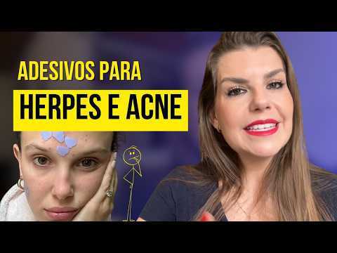 Adesivo que seca acne e herpes: solução ou problema? Dermatologista explica se realmente funciona