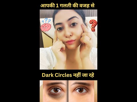 Dark Circles नहीं जा रहे? आप भी यही 1 गलती कर रहे हैं! #darkcircles #undereyecircles