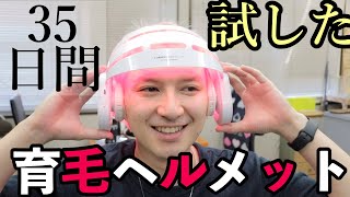 育毛できるヘルメットが衝撃すぎる！