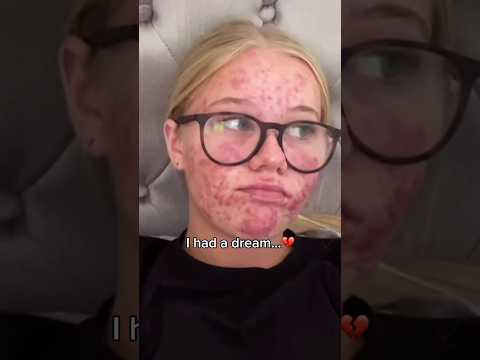 I had a Dream.. but Reality was a Nightmare untill this happened 😱 #skincare #shorts