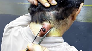 this bug was STUCK in his neck..