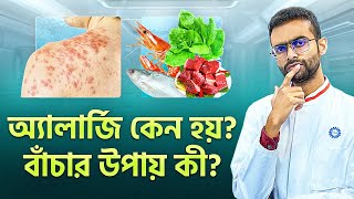 খাবার খেলে অ্যালার্জি হয়? বাঁচার উপায় কী? – Sabbir Ahmed
