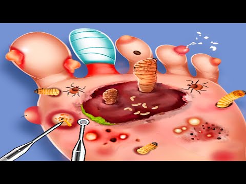 Foot Clinic - Gameplay Walkthrough - All Levels (IOS, Android)