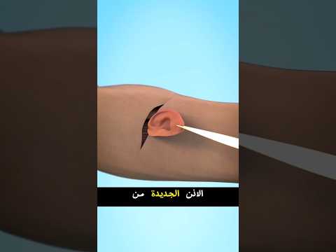 زراعة اذنك في ذراعك 😨