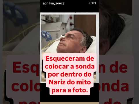 MAS NÃO É QUE ESQUECERAM DE COLOCAR A SONDA POR DENTRO DO NARIZ DO MITO