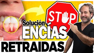 ✅ 𝗘𝗡𝗖𝗜𝗔𝗦 𝗥𝗘𝗧𝗥𝗔𝗜𝗗𝗔𝗦 SOLUCIÓN NATURAL : Mejor tratamiento para encías inflamadas y retraidas