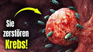 In DEINEM Darm leben Krebs-Killer! So aktivierst du sie