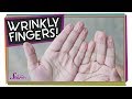 Understanding Wrinkly Fingers