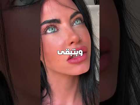بنت لون عينيها حير العالم 👀