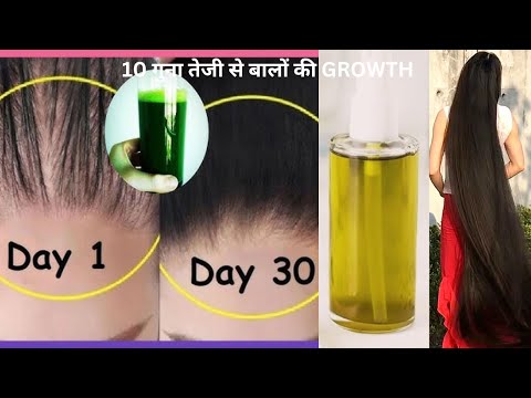 बस 15 मिनट इसे बालो में लगा ले बालो का झड़ना 3 दिन में बन्द कर Fast hair Regrowth