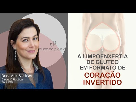 Clube da Plástica: Lipoenxertia de glúteo em formato de coração invertio