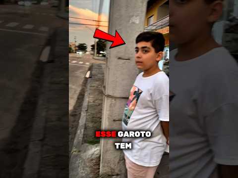 Esse Garoto tem uma Habilidade Diferenciada! Mas dessa vez deu RUIM! 😲 #shorts