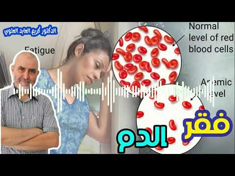 نظام غذائي خاص بمرضى فقر الدم   -   الدكتور كريم العابد العلوي   -