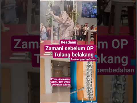 sebelum OP tulang belakang zamani#artist #zamanislam #shorts #trending #viral #video #fyp
