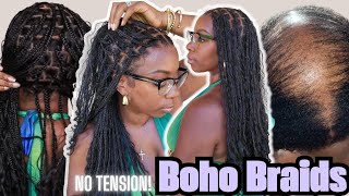 I Have PCOS Hair Loss, Let's Do Boho Braids! Low Tension, Easy FULL LACE Wig Install OMGHerHair