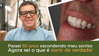 Passei 50 anos escondendo meu sorriso. Agora sei o que é sorrir de verdade! - Implace Implantes