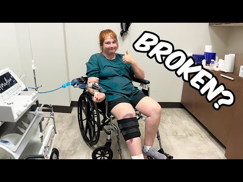 I think I broke my Leg 💔 | vlog gone wrong