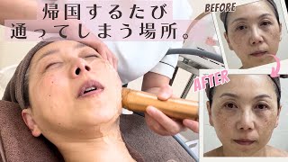 【50代美容】帰国するたび通う理由｜痛みゼロでリフトアップ？ソニックフィット正直レビュー（リリーオン）