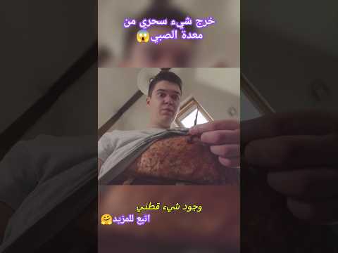 خرج شيء سحري من معدة الصبي#افلام #shorts
