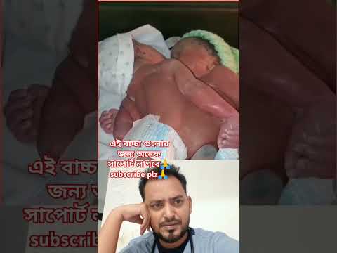 আল্লাহ মাফ করে দাও আমাদের 🙏❤️#shorts #ytshorts #baby #nicumom #cuteanimal #nicu #cutebaby #hospital